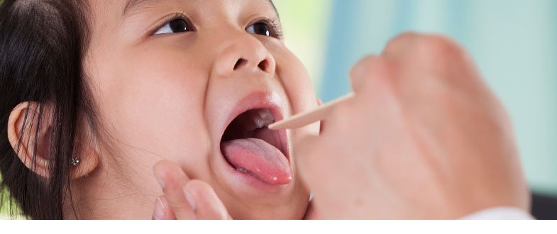 Read more about the article MUMPS AND ITS EFFECTS